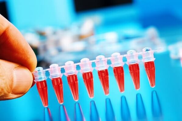 Blood test for cervical spondylosis to rule out the development of cancer