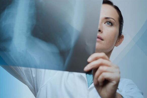 X-rays are a common method to diagnose cervical spondylosis.