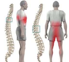 pain in the spine with thoracic osteoarthritis
