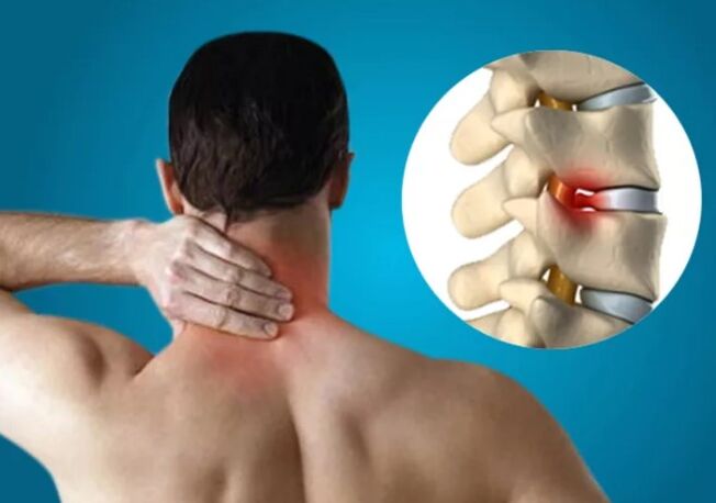 Cervical bone