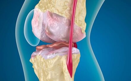 Reasons for the development of knee joint disease